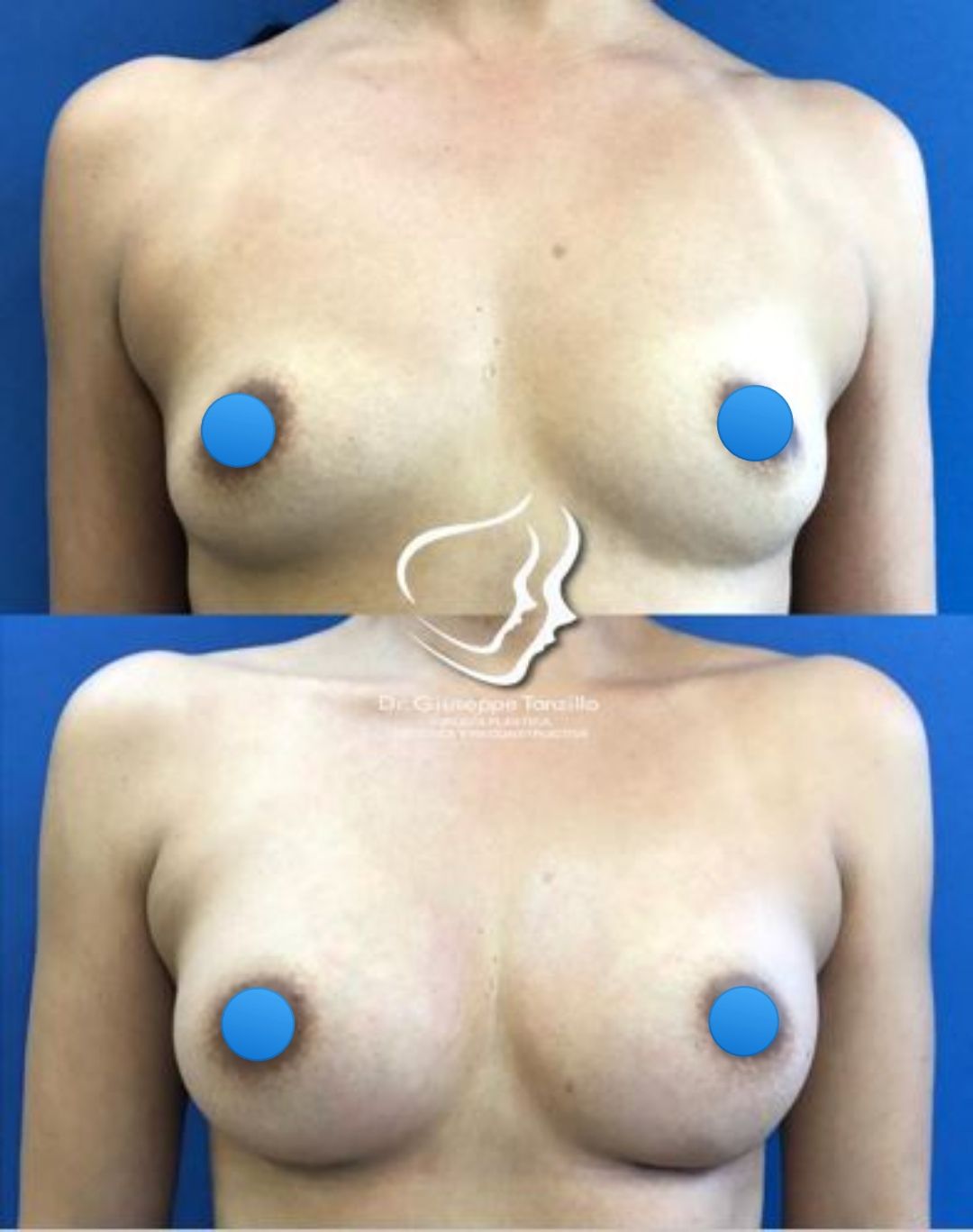 Giuseppe Tanzillo-65