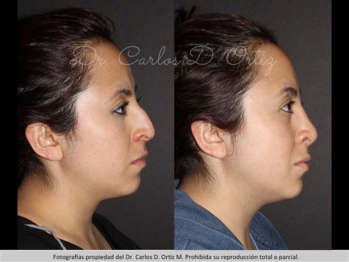 Carlos David Ortiz Moreno-42