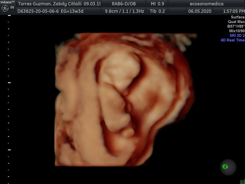 Héctor Bernardo Acevedo Manrique-18