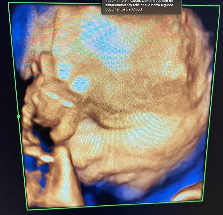 Andrés Murillo Mendoza-4