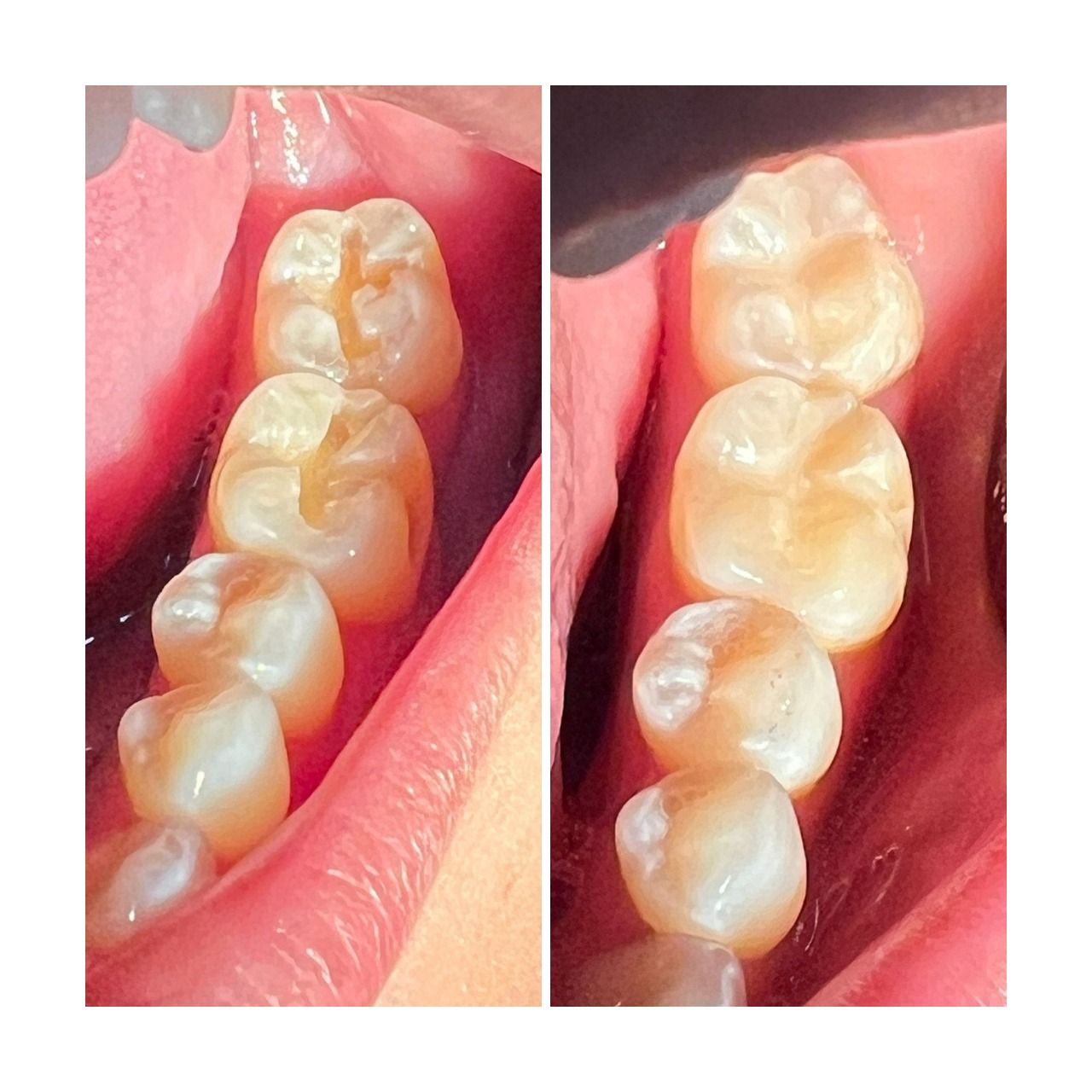 Sergio Torres Rivera-14