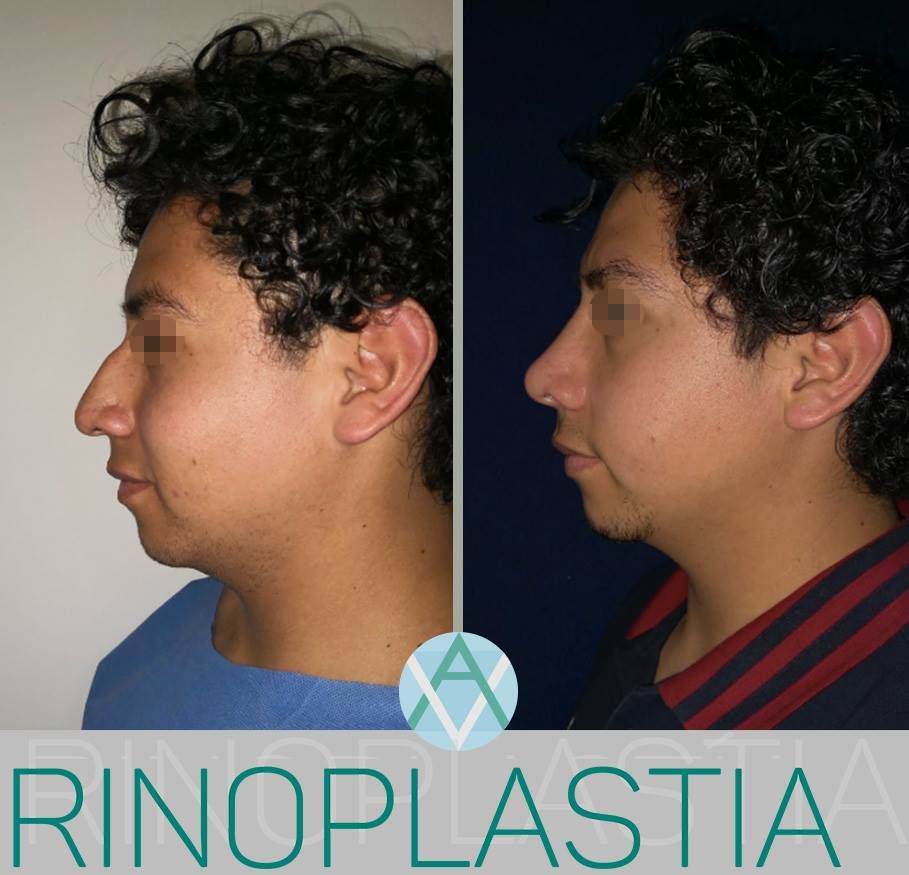 Alfonso Villaseñor Herrero-32