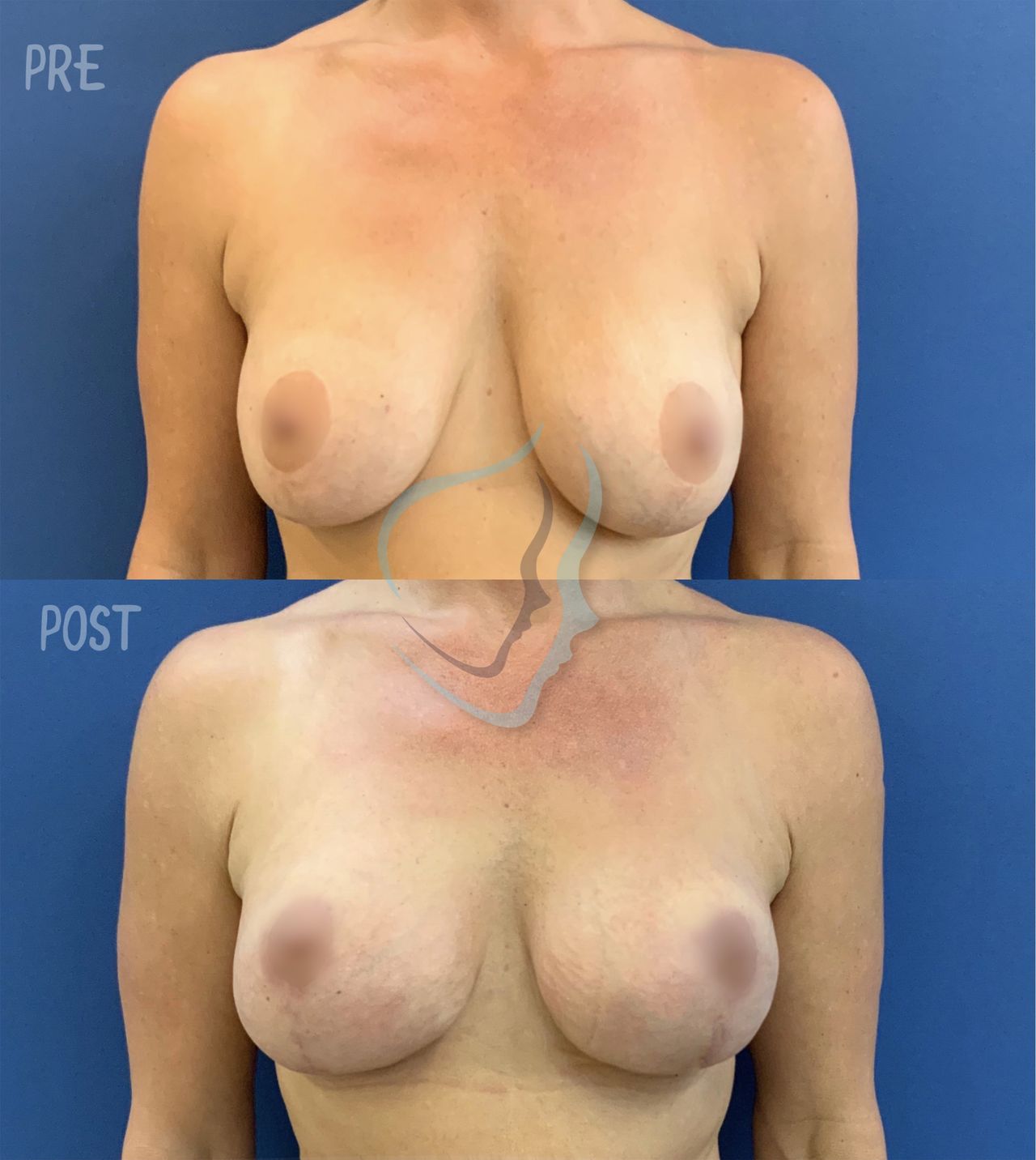 Giuseppe Tanzillo-63