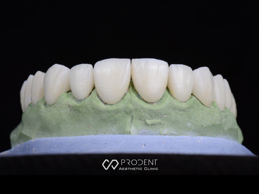 Ramiro Ivan Pérez Murillo-53