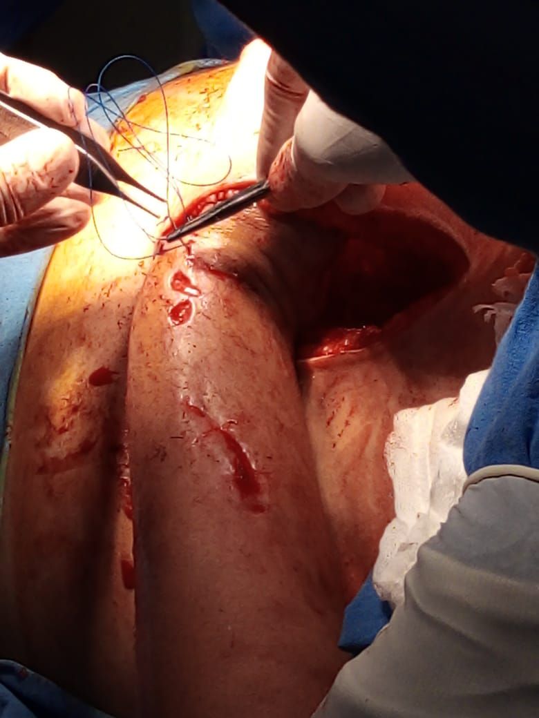 Federico Quintana De La Rosa-49