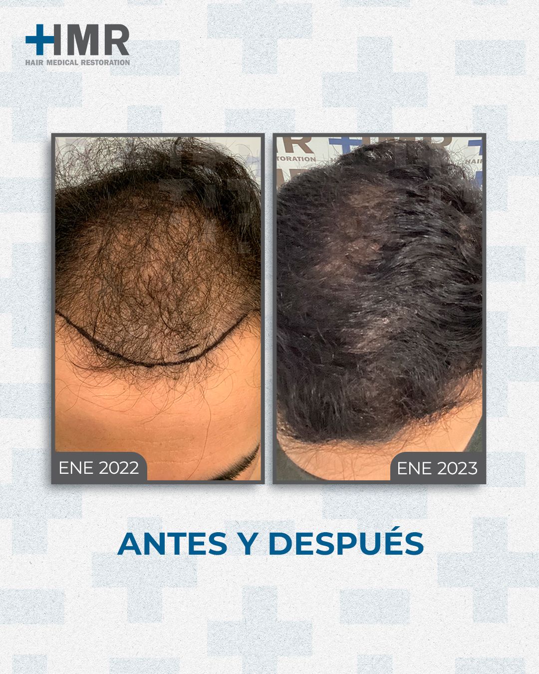 Mendelhsson Mata Cortes-5