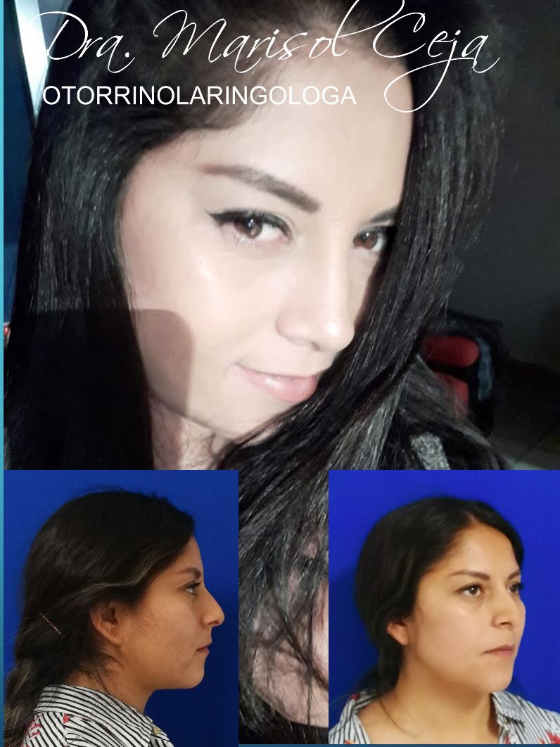 Marisol Ceja Zepeda-35