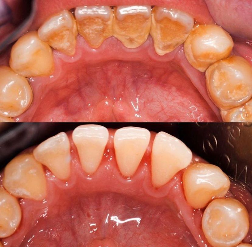 Alejandro Angelo López Díaz-5