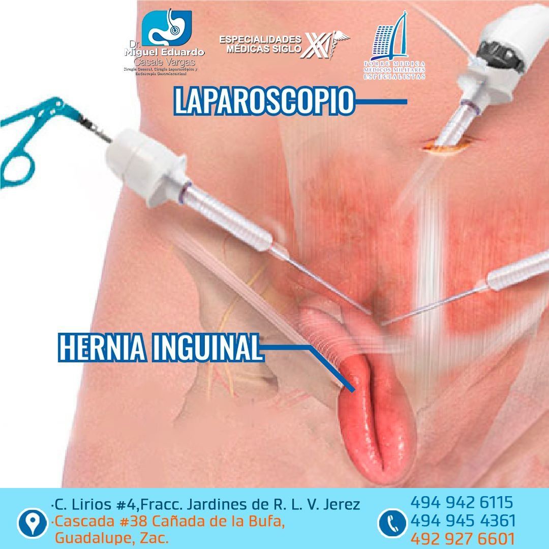 Miguel Eduardo Casale Vargas-14