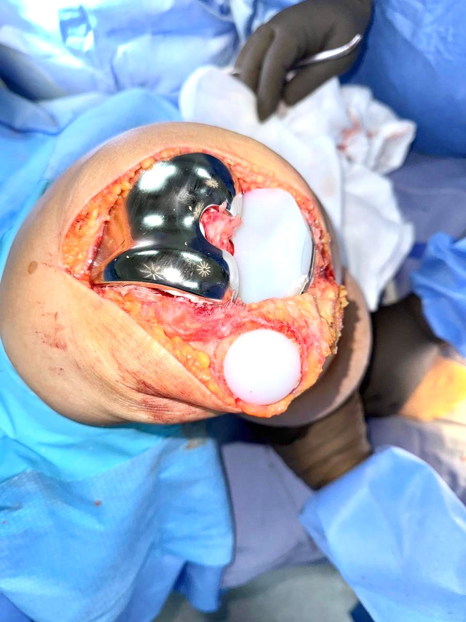 Monica Álvarez Cedeño-2