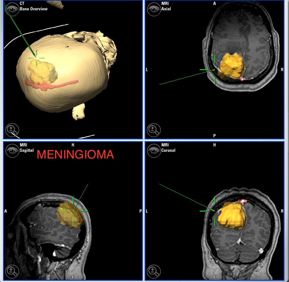 Enrique De Obieta Cruz-33