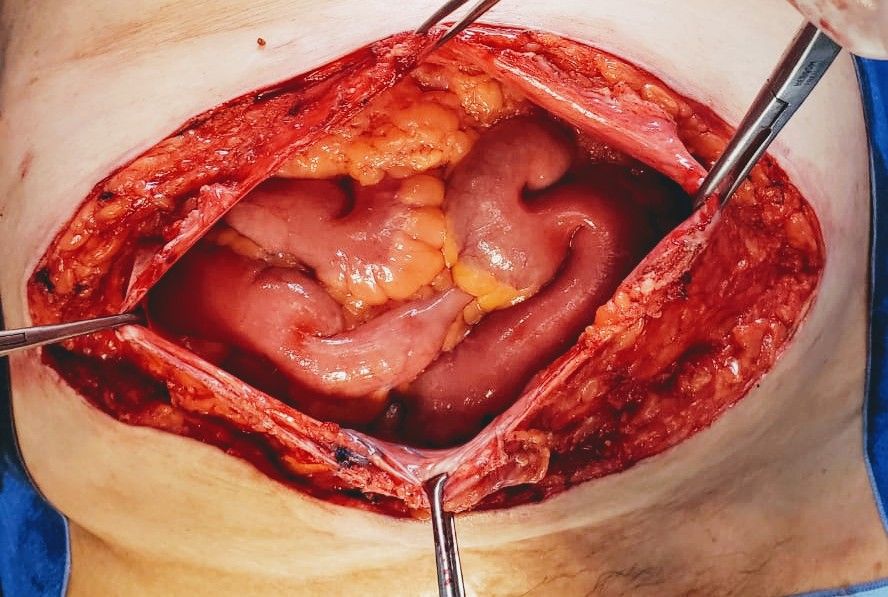 Luis Angel Medina Andrade-17