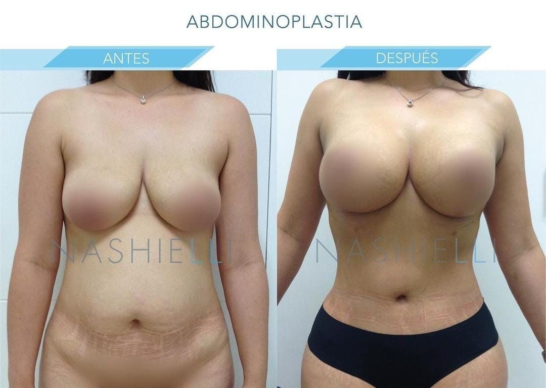 Nashielli Torres Espinosa Chiu-0