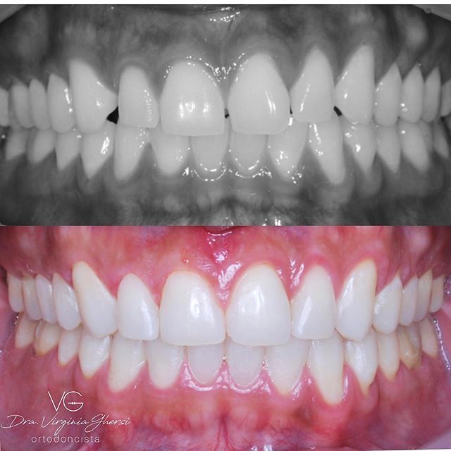 Maria Virginia Ghersi Angulo-3