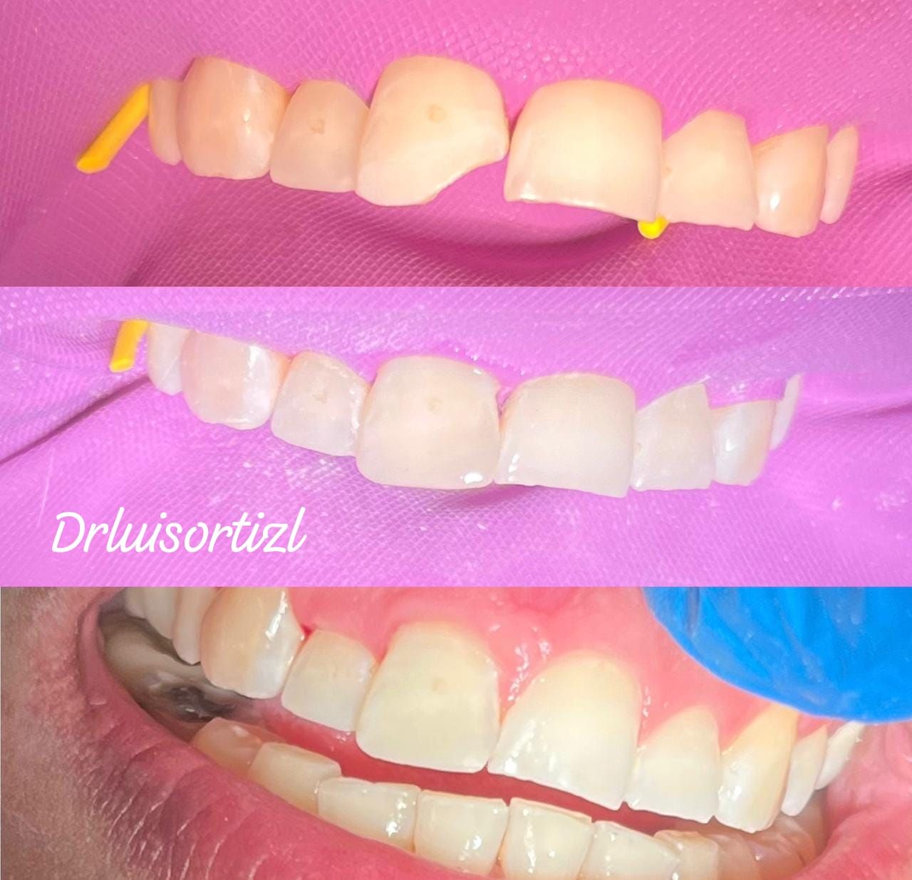 Luis Ángel Ortiz López-32