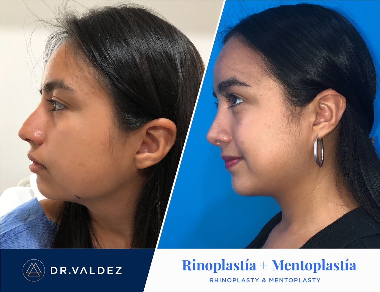 Pedro Arturo Valdez Gomez-15