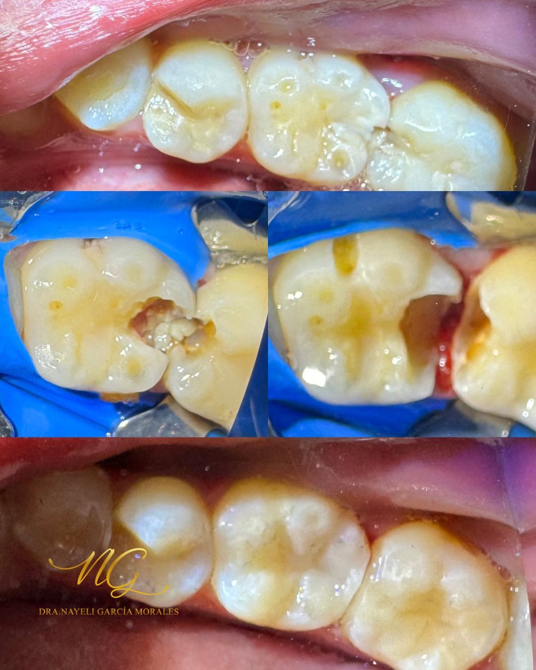 Nayeli Garcia Morales-3