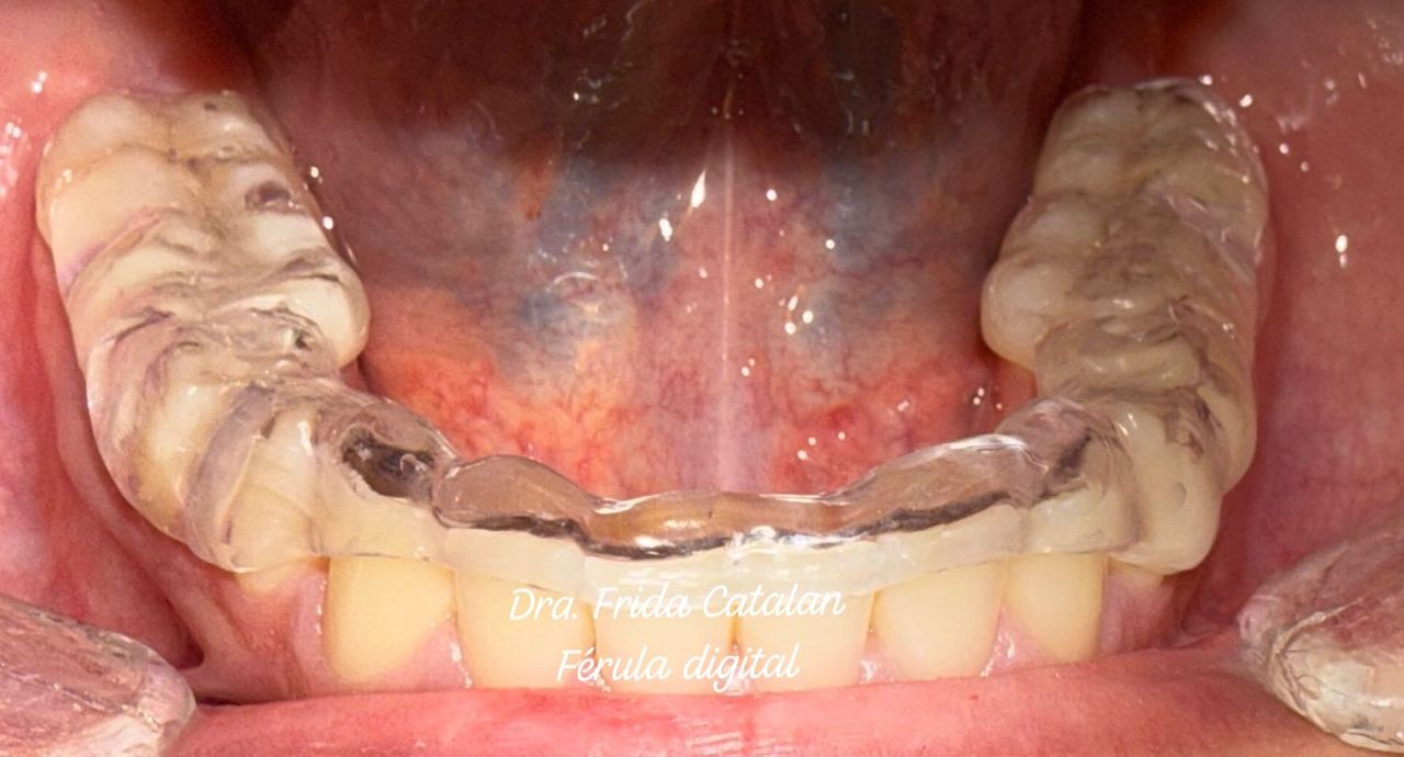 Frida Catalan Verdi-8