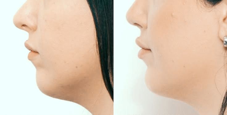 Miguel Ángel Moreno Alba-5