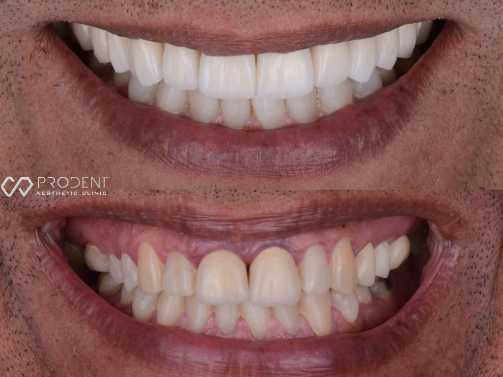 Ulises Pérez Murillo-94