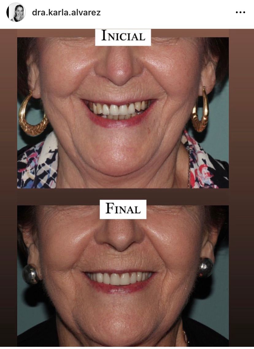 Karla Alvarez Treviño-6