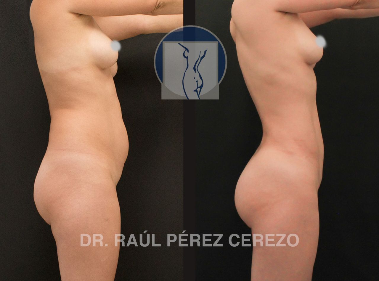 Raúl Pérez Cerezo-31