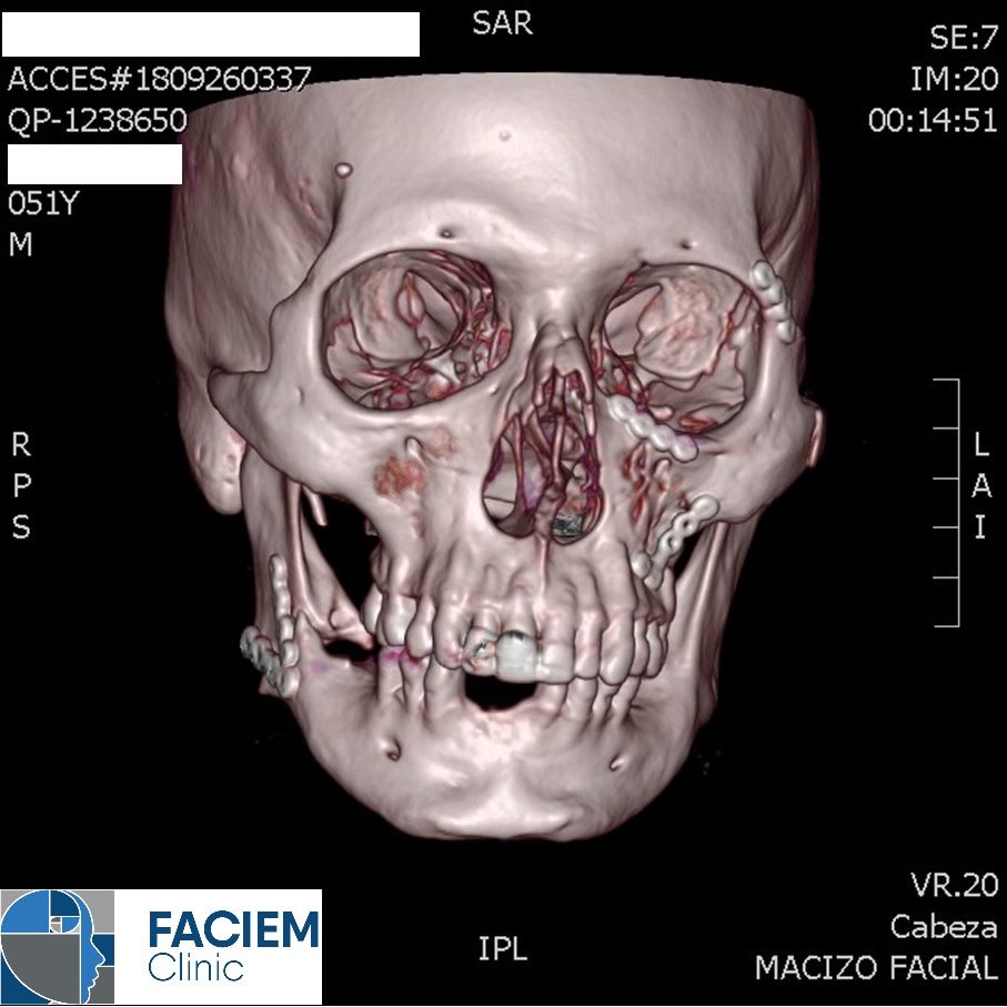Arlen Colín Ordaz-39