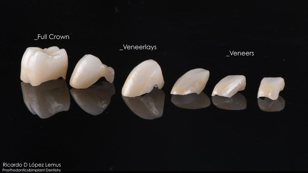 Ricardo López Lemus-27