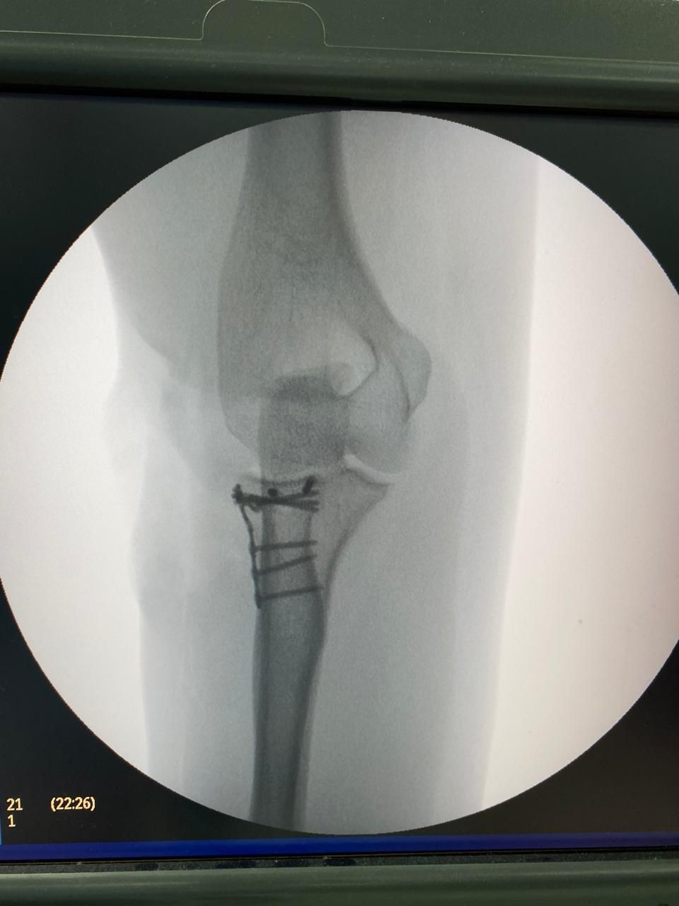 Victor Manuel Alayon Vazquez-7