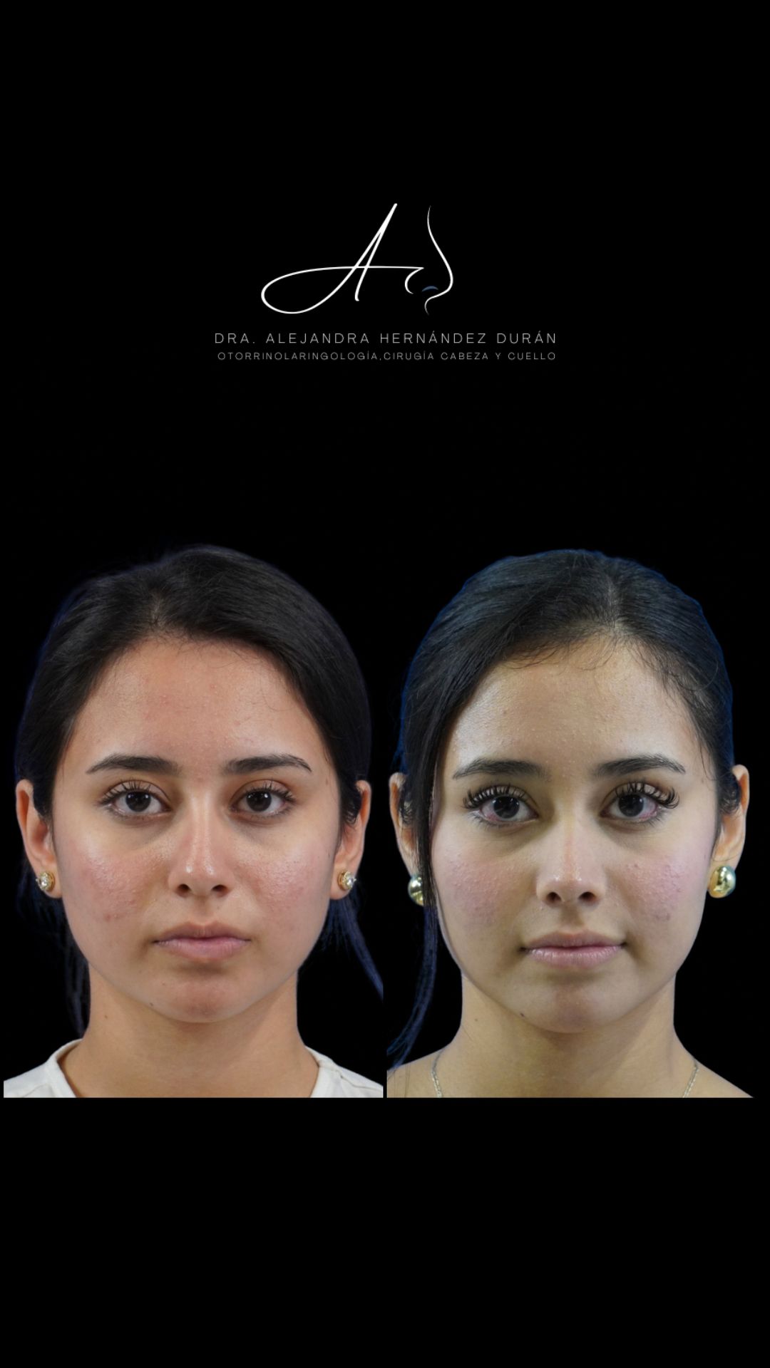 Alejandra Elizabeth Hernández Durán-49