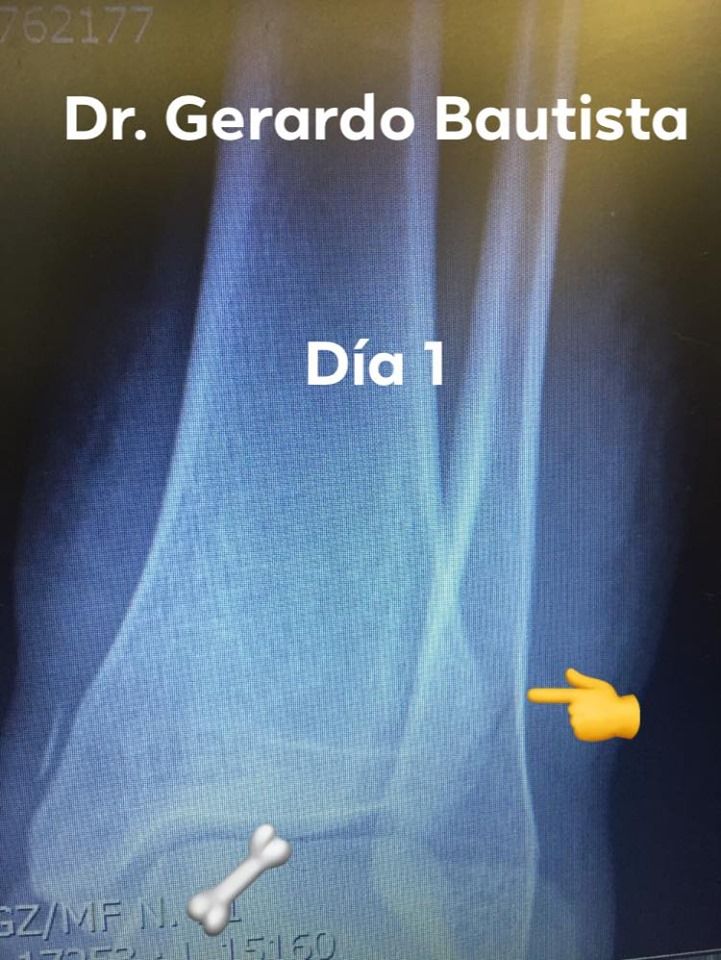 Gerardo Bautista Díaz-1