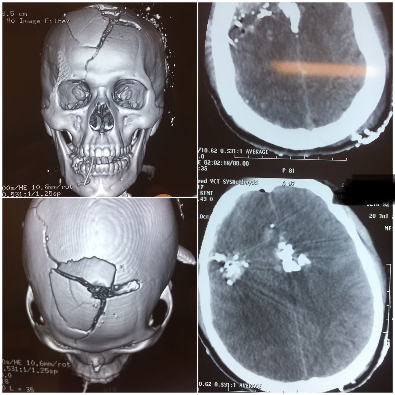 Michelle Omar Calderon Sánchez-12