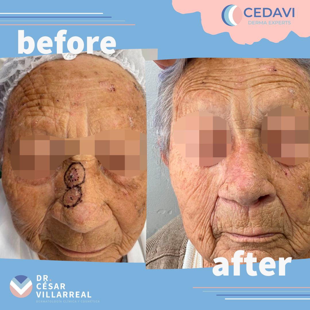 César Daniel Villarreal Villarreal-15