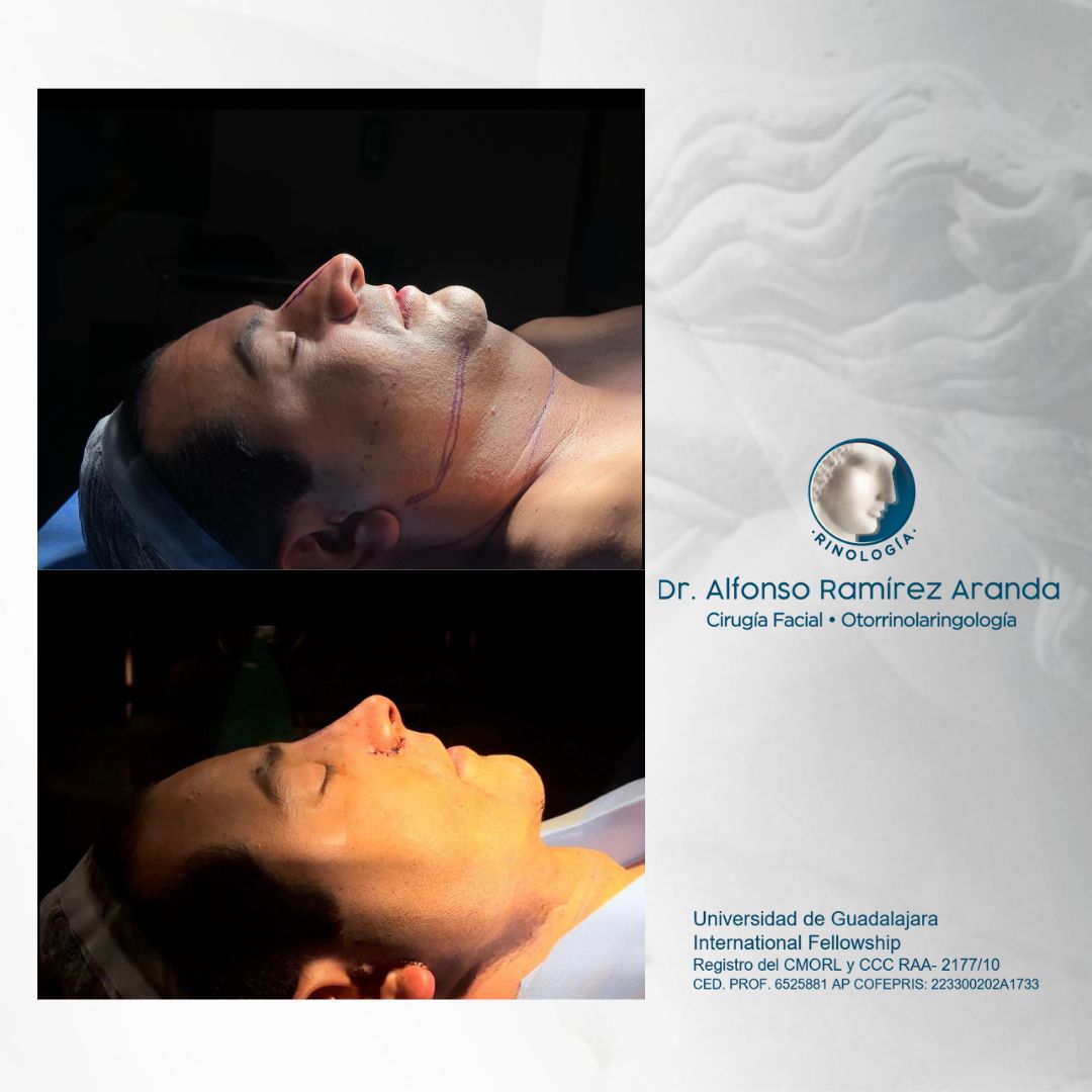 Alfonso Ramírez Aranda-3