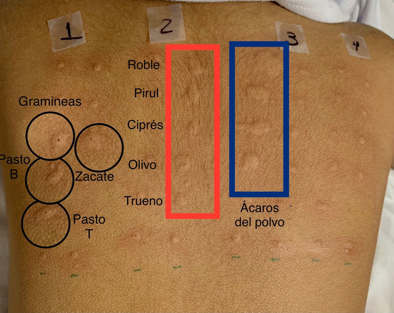 Arturo Gaspar López-3