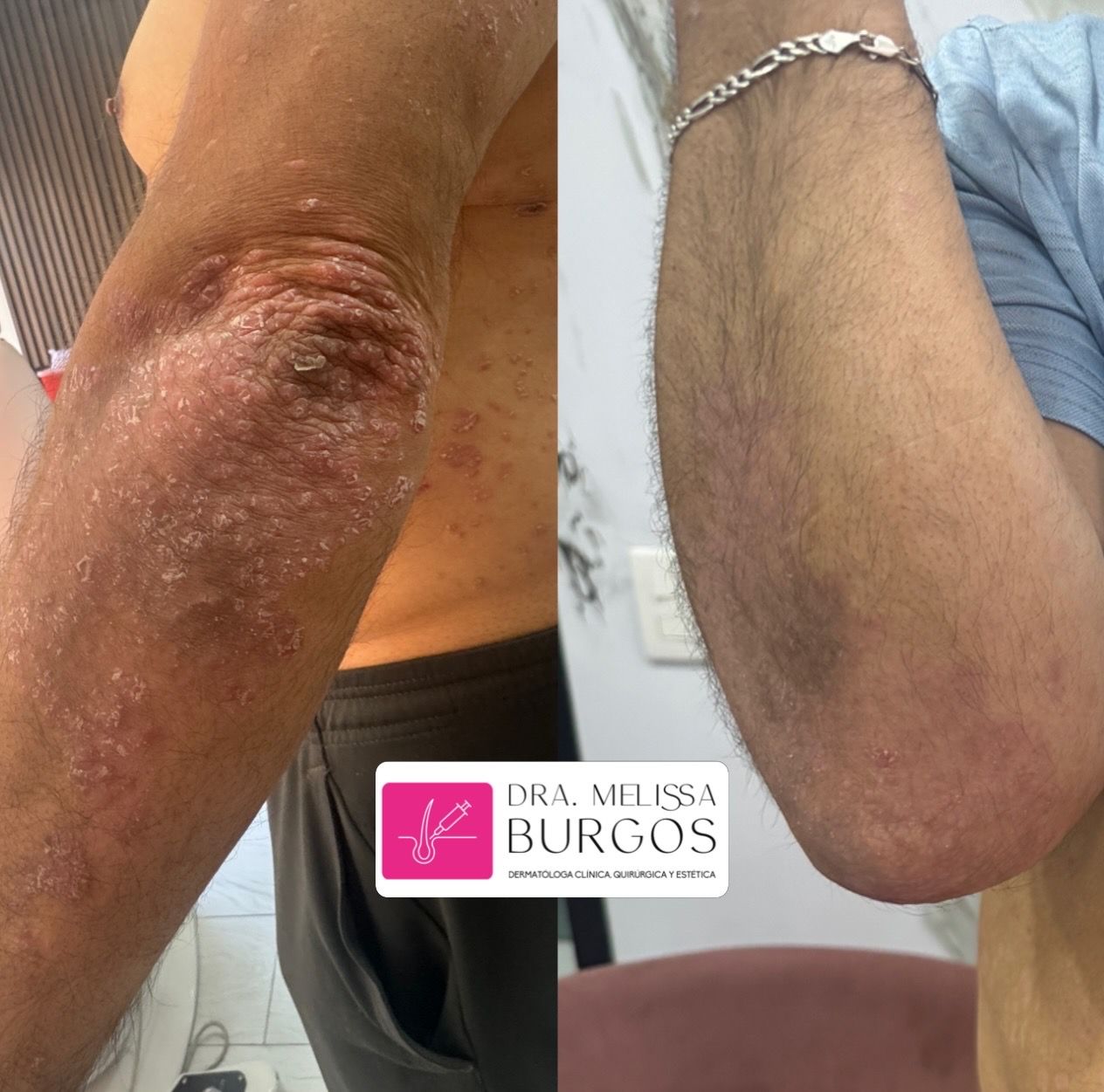 Melissa Burgos Romero-23