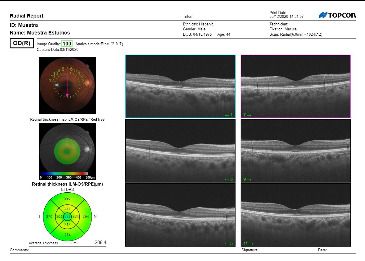 Juan Jose Cueto Gomez-18