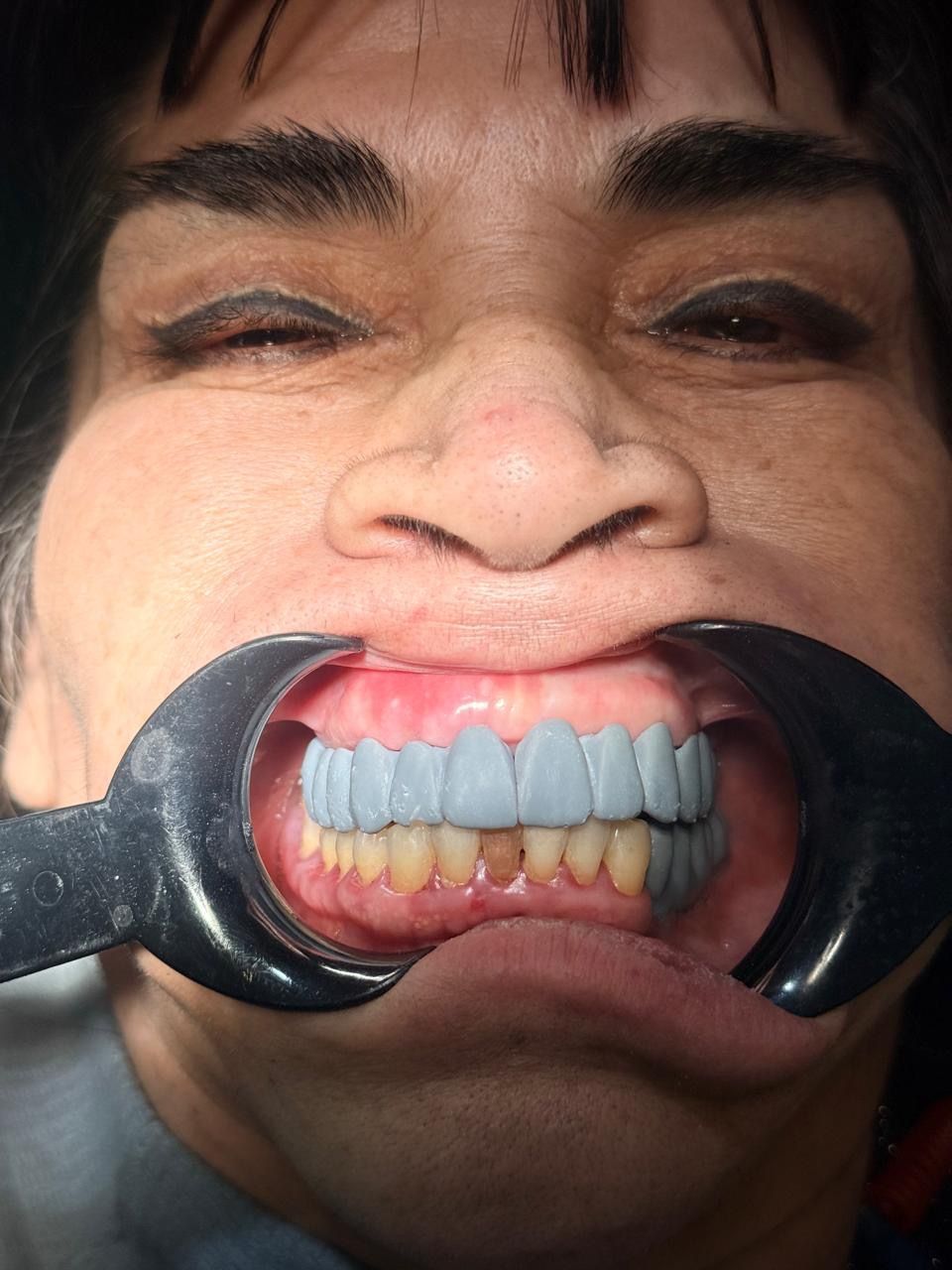 Oswaldo Sanchez Gonzalez-10