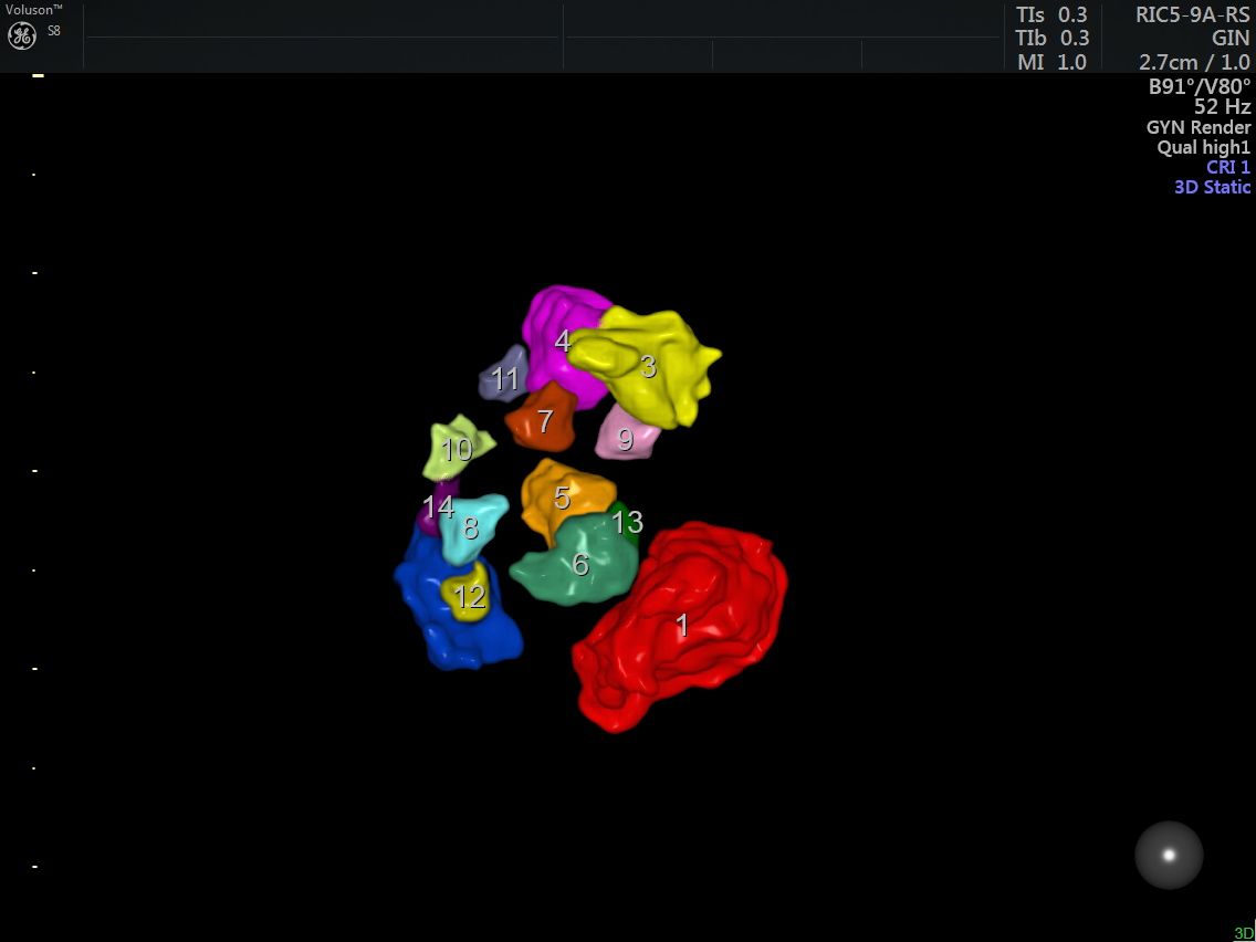 Griselda Reyes Torres-82