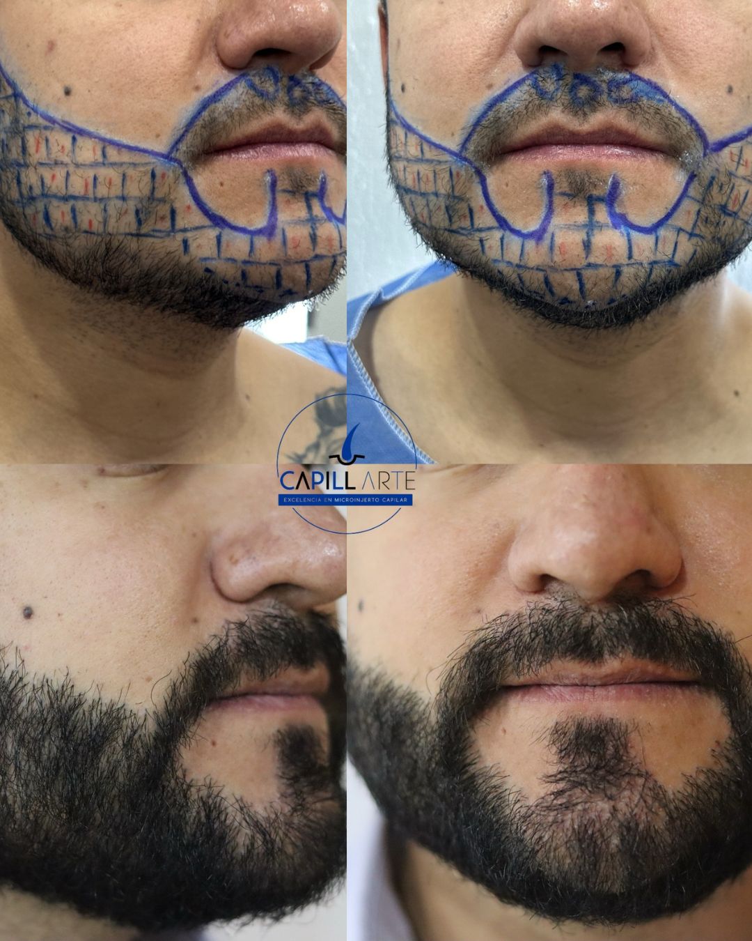 Adrian Hernandez Lopez-12