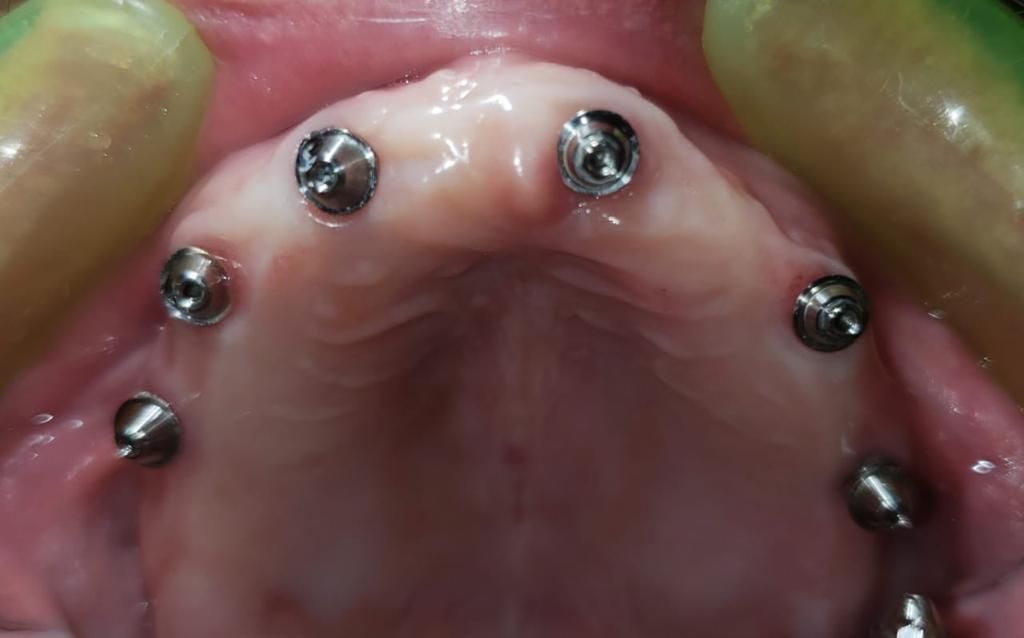 Alfonso Gonzalez Ocaranza-3