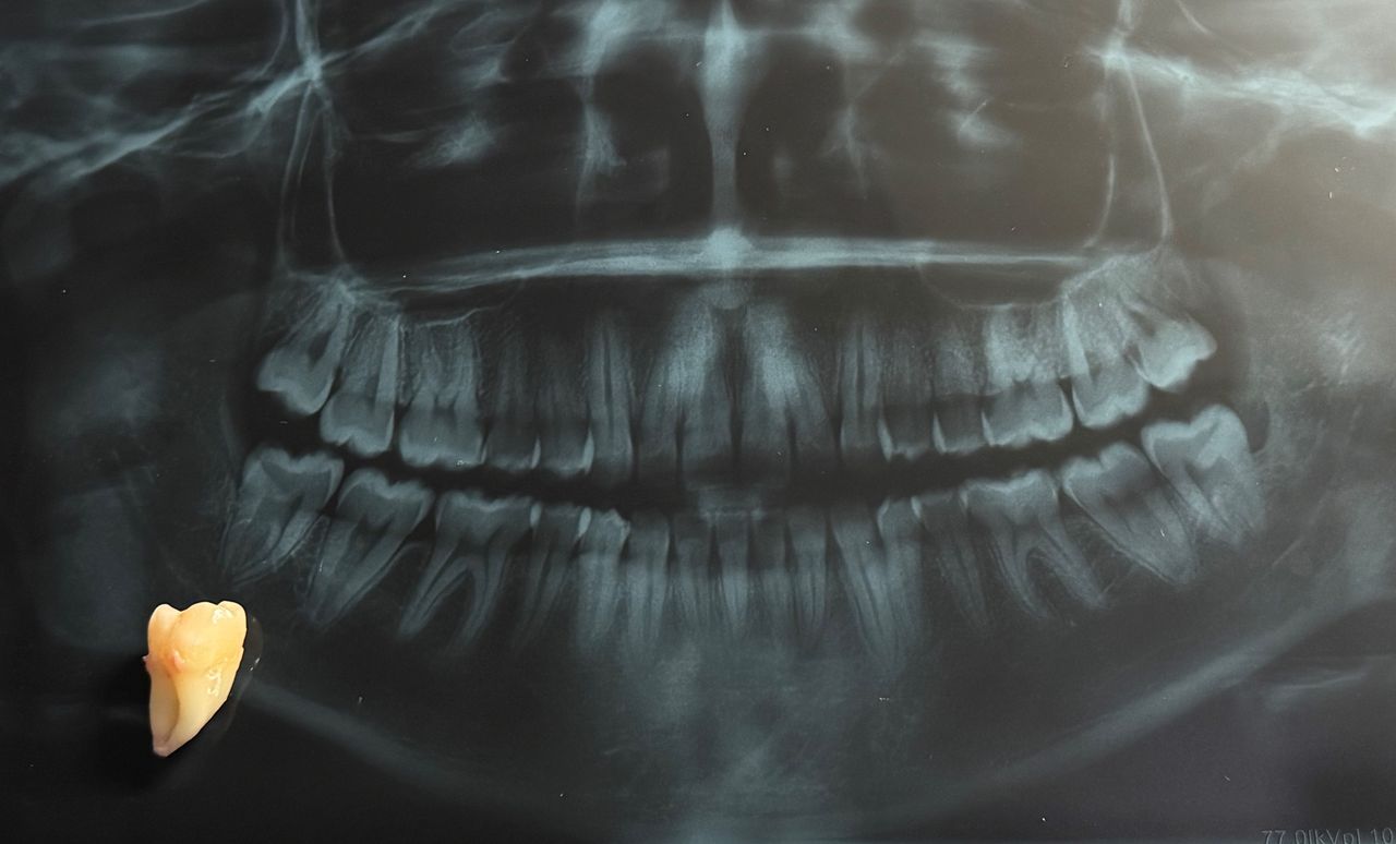 Luis Angel Carranza Resendez-7