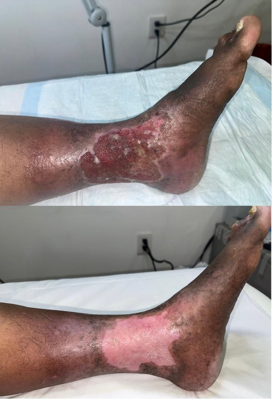 Jhonatan López González-20