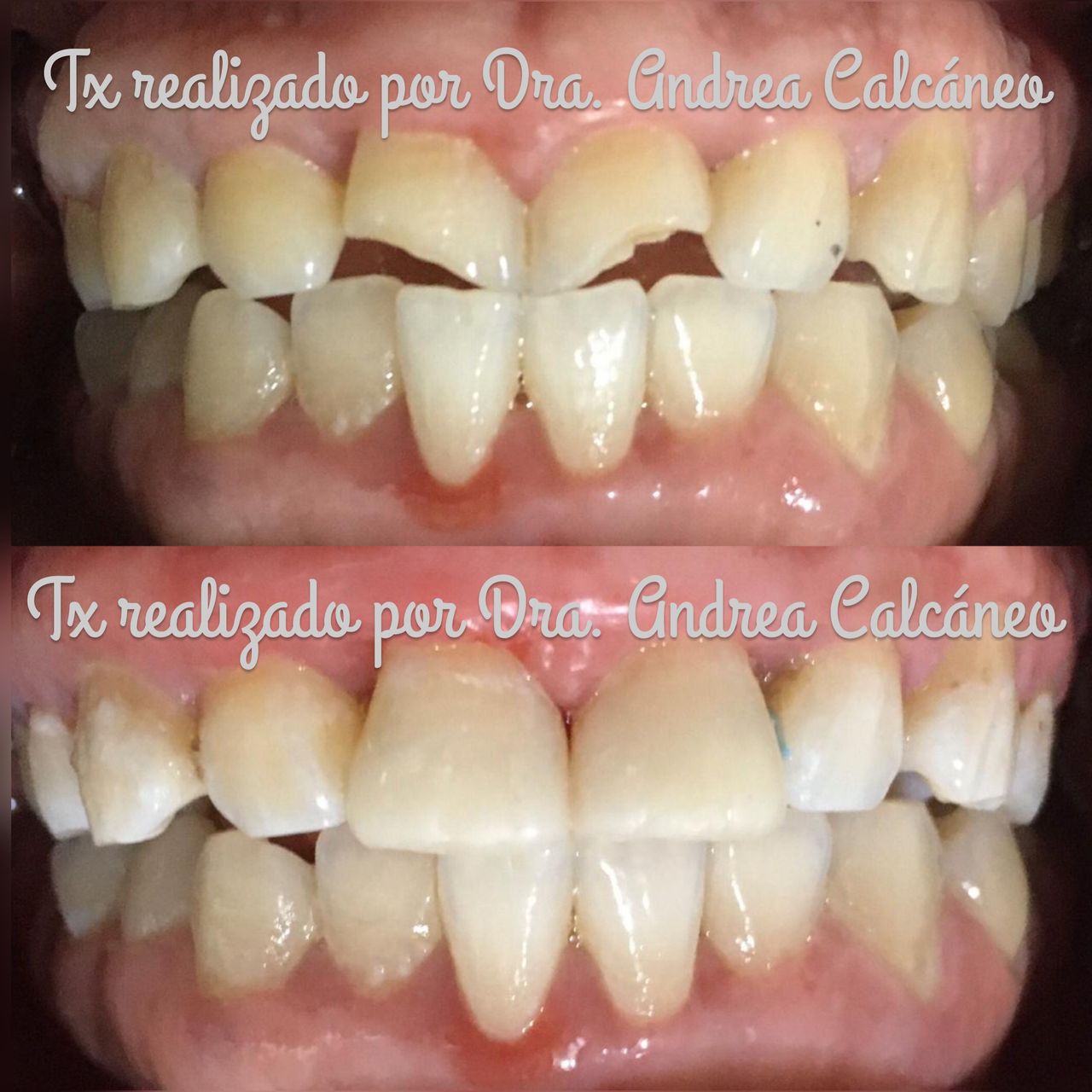 Andrea Calcáneo Castañeda-6