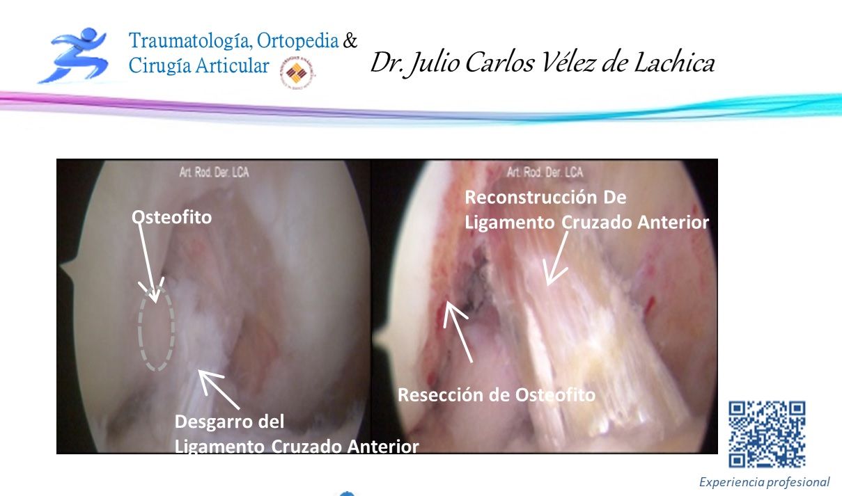 Julio Carlos Vélez De Lachica-4