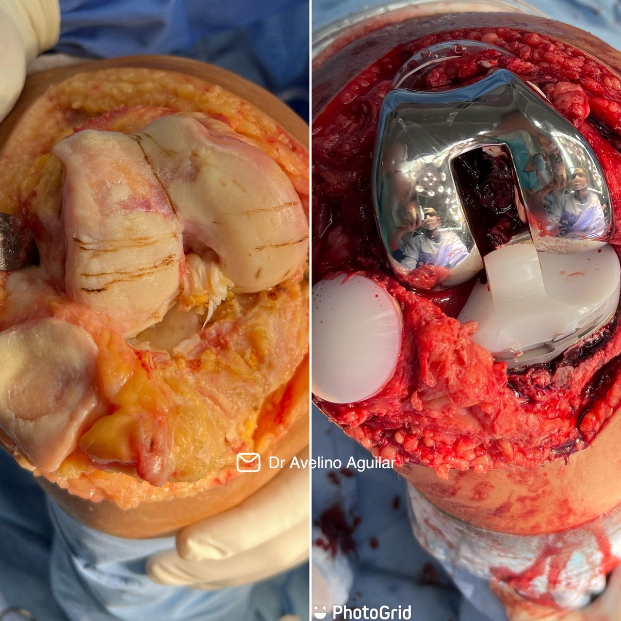 Avelino Aguilar Merlo-6