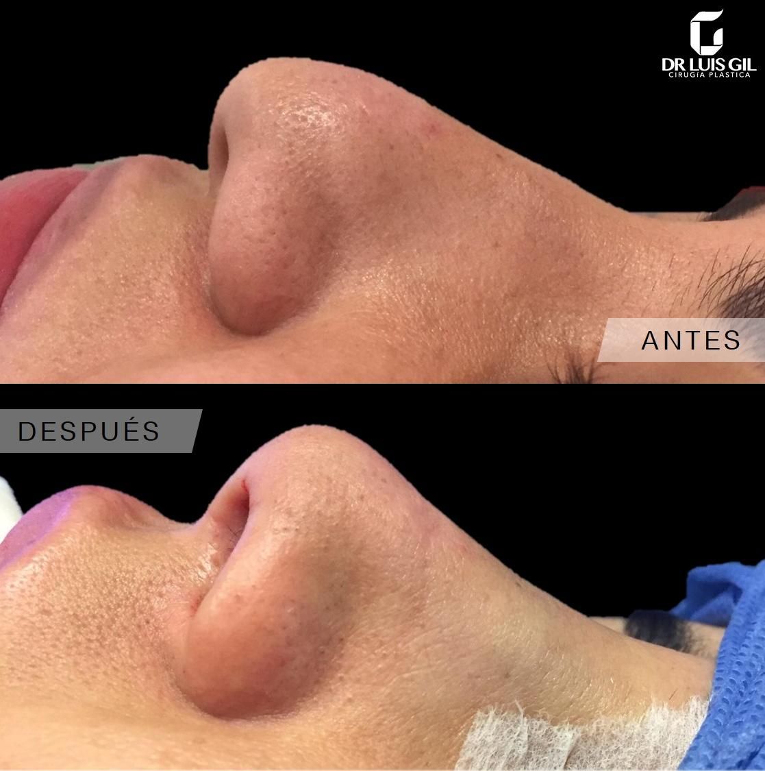 Luis Atilio Gil Pérez-26