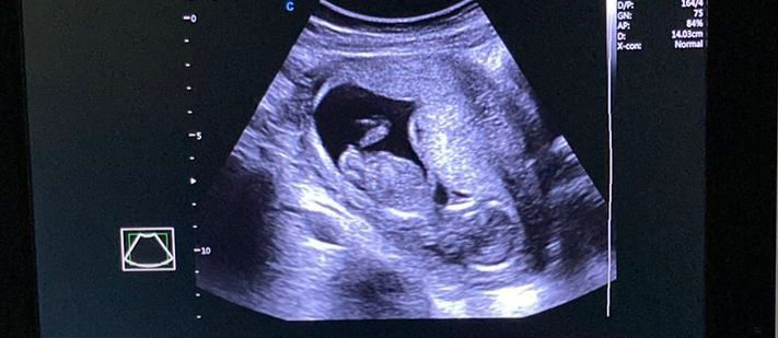 Linda Carmín Jimenez Ibáñez-8