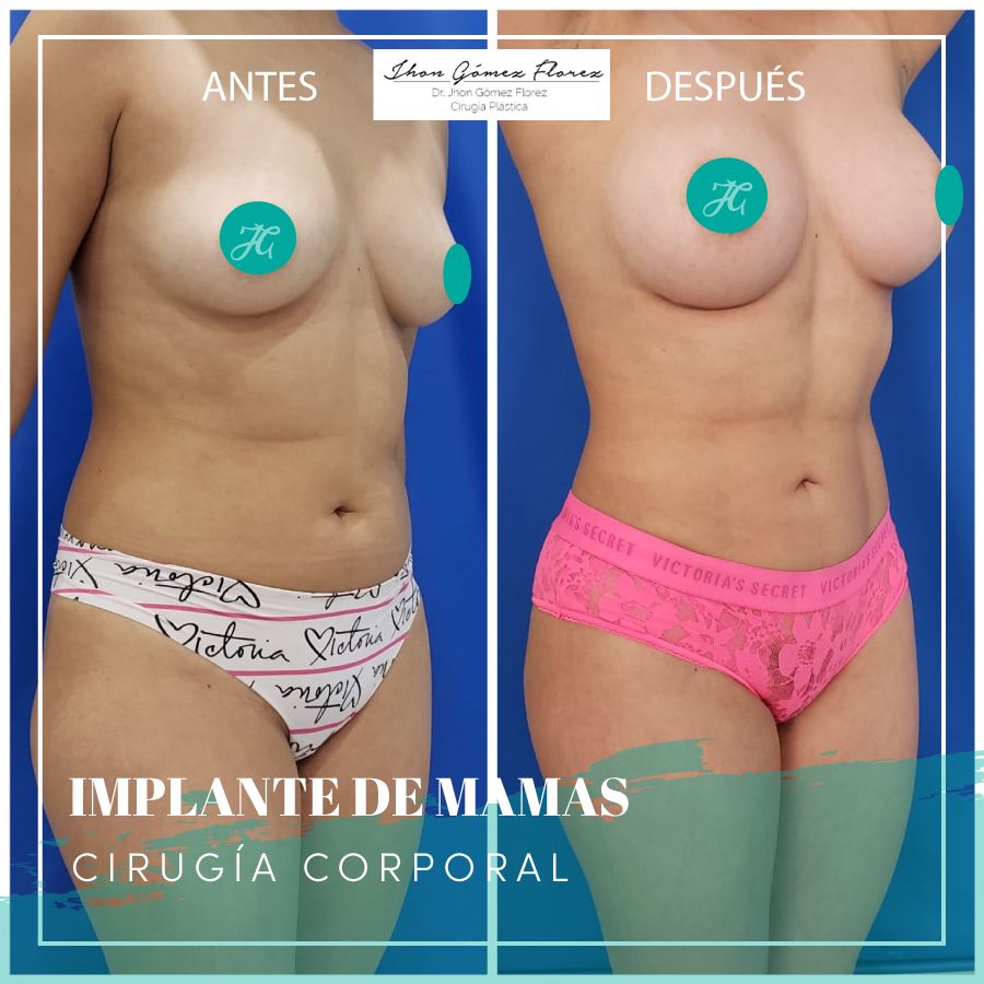 Jhon César Gómez Florez-39