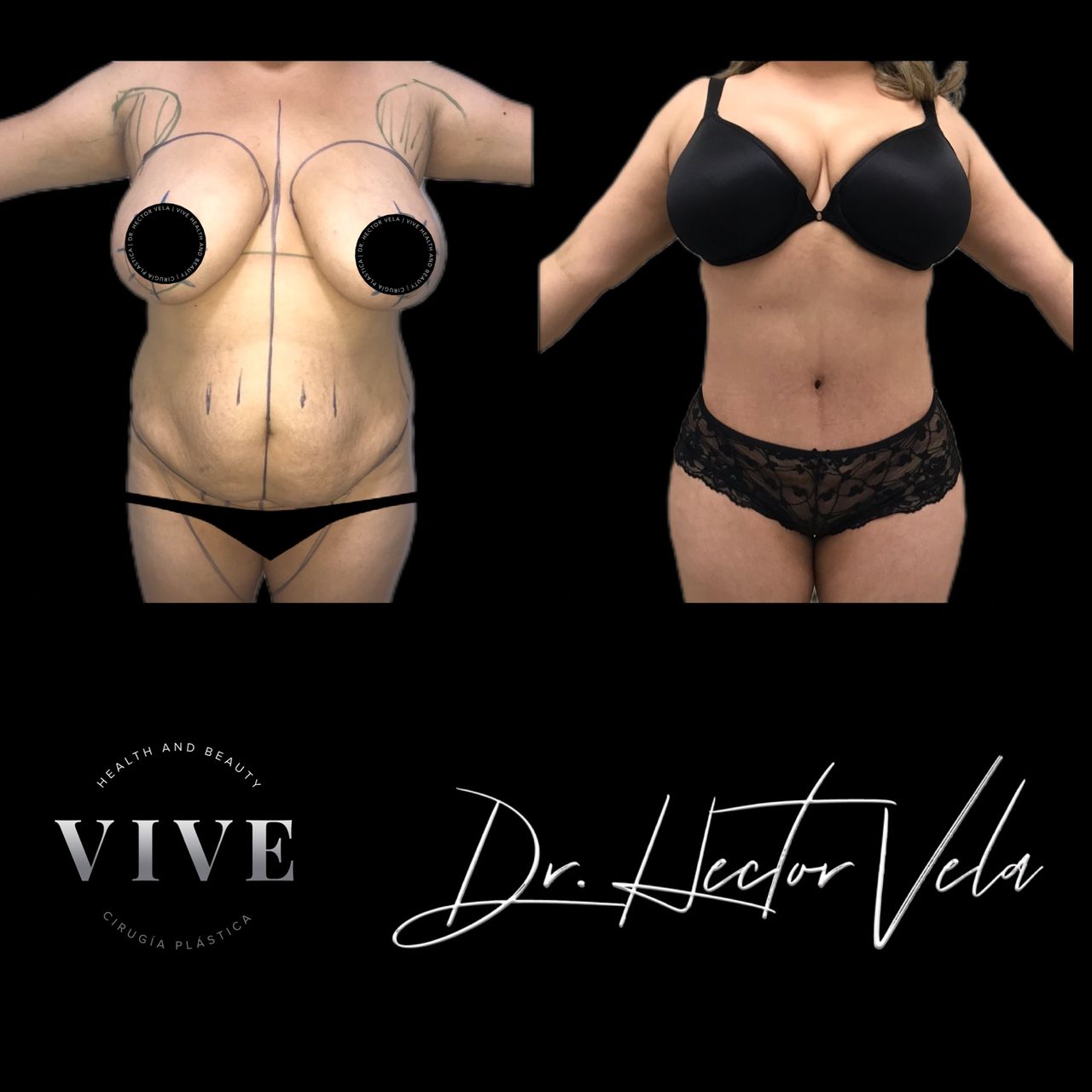 Héctor Eduardo Vela Cardona-224